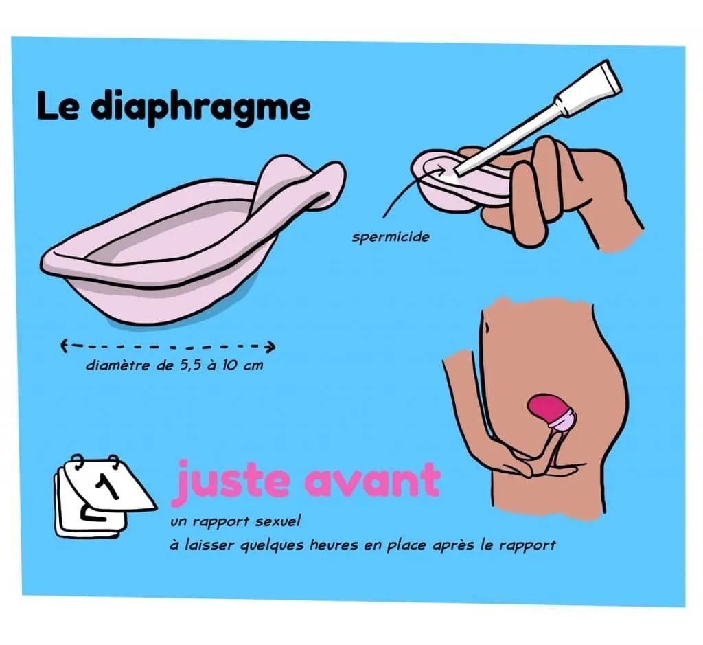 , 重磅新福利！法国免费避孕措施扩至所有女性！不再限制年龄！羊毛薅起来！, My Crazy Paris